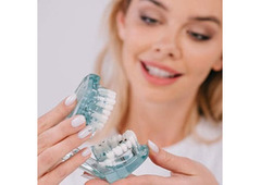 Get Dental Implants at Alexander Heights